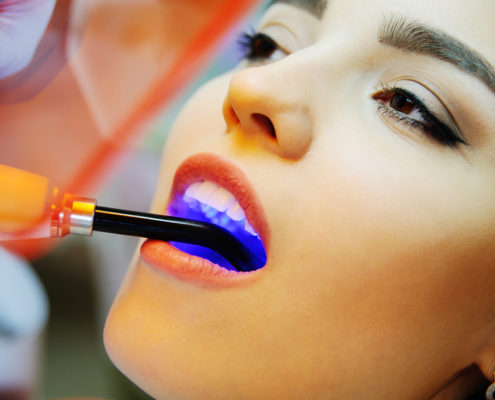 Emfrakseis Cosmetic Dentistry