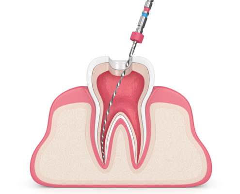 Endodontia Endodontics