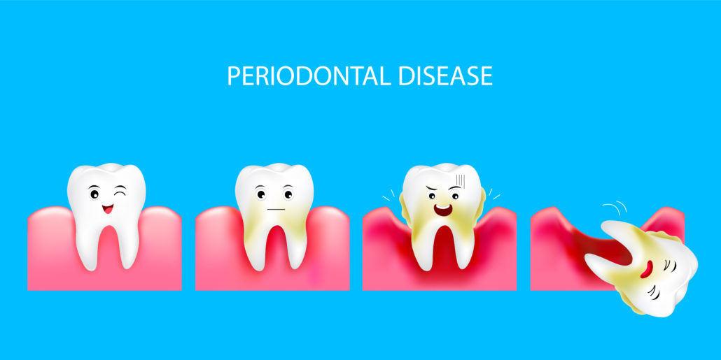 PerioNosos Periodontology